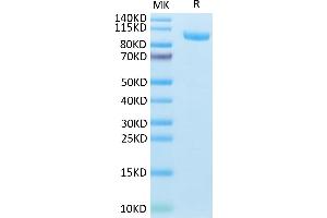 Mouse CDH17 on Tris-Bis PAGE under reduced condition. (LI Cadherin Protein (AA 26-786) (His tag))