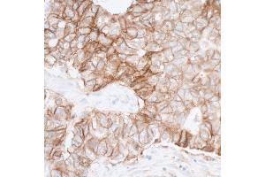 Immunohistochemistry (IHC) image for anti-Poliovirus Receptor (PVR) (AA 28-329) antibody (ABIN7449549) (Recombinant Poliovirus Receptor anticorps  (AA 28-329))
