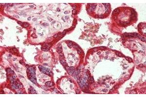 Detection of IL1RL1 in Human Placenta Tissue using Polyclonal Antibody to Interleukin 1 Receptor Like Protein 1 (IL1RL1) (IL1RL1 anticorps  (AA 162-349))