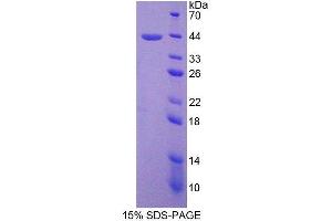 SDS-PAGE analysis of Human SPD Protein. (SFTPD Protéine)