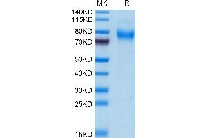 Mouse TREML2/TLT-2 on Tris-Bis PAGE under reduced condition. (TREML2 Protein (AA 25-270) (His tag))