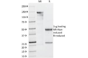 SDS-PAGE Analysis Purified Galectin-13 MAb (PP13/1161).