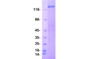 Validation with Western Blot