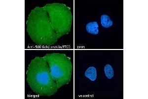 (ABIN185267) Immunofluorescence analysis of paraformaldehyde fixed U2OS cells, permeabilized with 0.