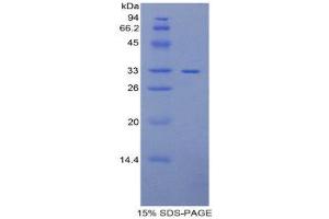 SDS-PAGE (SDS) image for Pitrilysin Metallopeptidase 1 (PITRM1) (AA 653-926) protein (His tag) (ABIN1879022)