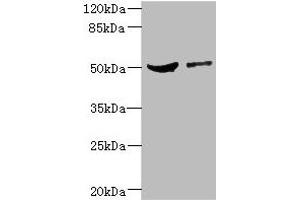 Western blot All lanes: CPN1 antibody at 6.
