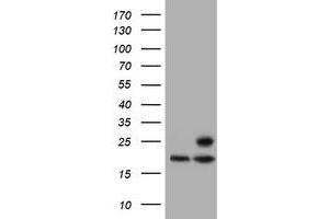 Western Blotting (WB) image for anti-Proteasome (Prosome, Macropain) Subunit, beta Type, 9 (Large Multifunctional Peptidase 2) (PSMB9) (AA 21-219) antibody (ABIN1491194) (PSMB9 anticorps  (AA 21-219))