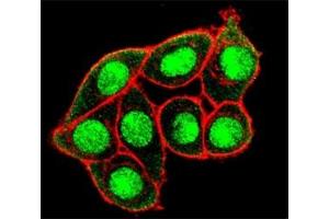 Confocal immunofluorescent analysis of phospho-MUC1 antibody and HeLa cells followed by Alexa Fluor 488-conjugated goat anti-rabbit lgG (green).