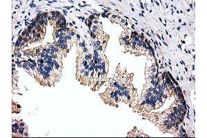 Immunohistochemical staining of paraffin-embedded Human prostate tissue using anti-FAM40A mouse monoclonal antibody. (STRIP1 anticorps)