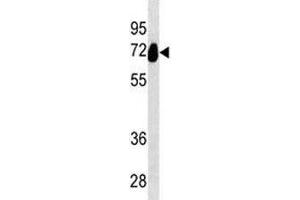 Alkaline Phosphatase antibody western blot analysis in HeLa lysate.