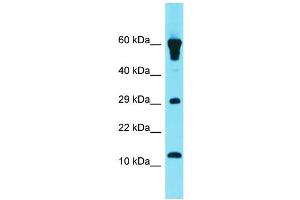 Host: Rabbit Target Name: GCSAML Sample Type: Fetal Heart lysates Antibody Dilution: 1. (GCSAML anticorps  (N-Term))