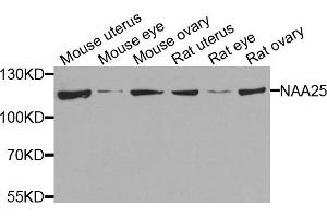 Western blot analysis of extracts of various cells, using NAA25 antibody. (NAA25 anticorps)