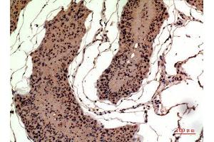 Immunohistochemistry (IHC) analysis of paraffin-embedded Rat Testis, antibody was diluted at 1:100. (HMGB1 anticorps  (Internal Region))
