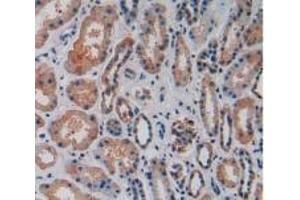 anti-Vascular Cell Adhesion Molecule 1 (VCAM1) (AA 109-318) antibody