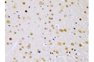 Immunohistochemistry of paraffin-embedded mouse brain using IKKβ antibody (ABIN3022875, ABIN3022876, ABIN3022877 and ABIN6219275) at dilution of 1:100 (40x lens).
