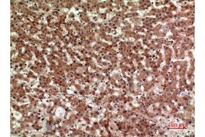 Immunohistochemistry (IHC) analysis of paraffin-embedded Human Liver, antibody was diluted at 1:100.
