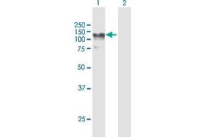 Western Blot analysis of HIP1R expression in transfected 293T cell line by HIP1R MaxPab polyclonal antibody. (HIP1R anticorps  (AA 1-1068))