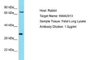 Host: Rabbit Target Name: KIAA2013 Sample Tissue: Human Fetal Lung Antibody Dilution: 1ug/ml (KIAA2013 anticorps  (C-Term))