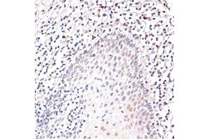Immunohistochemistry of paraffin-embedded human tonsil using c-Jun antibody (ABIN6131074, ABIN6142670, ABIN6142671 and ABIN6215187) at dilution of 1:100 (40x lens).