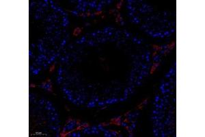Immunohistochemistry analysis of paraffin-embedded rat brain using TESK1 (ABIN7075866) at dilution of 1: 500