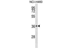 Western blot analysis of SERPINB1 Antibody (Center) Cat. (SERPINB1 anticorps  (Middle Region))
