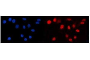 IF analysis of LEF1 using anti-LEF1 antibody (ABIN7600016).