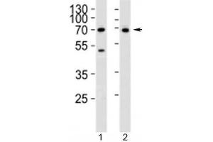Western blot analysis of lysate from 1) Jurkat and 2) SK-BR-3 cell line using CD46 antibody at 1:1000.
