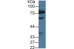 Detection of MTHFR in Human Jurkat cell lysate using Polyclonal Antibody to Methylenetetrahydrofolate Reductase (MTHFR) (MTHFR anticorps  (AA 1-325))