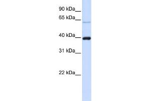 WB Suggested Anti-PHF6 Antibody Titration:  0.
