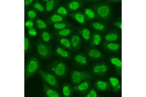 Immunofluorescence analysis of U2OS cells using TERF2IP antibody  at dilution of 1:100. (RAP1 anticorps  (AA 1-280))
