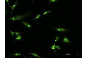 Immunofluorescence of purified MaxPab antibody to GOLGA2 on HeLa cell.