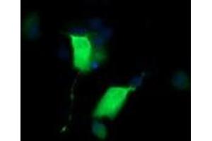 Image no. 2 for anti-Cancer/testis Antigen 1B (CTAG1B) antibody (ABIN1499902) (CTAG1B anticorps)