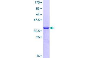 Image no. 1 for Acylphosphatase 2, Muscle Type (Acyp2) (AA 1-99) protein (GST tag) (ABIN1305831)
