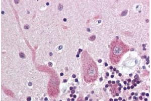 anti-Alpha, beta Synuclein antibody