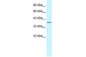 Human heart; WB Suggested Anti-SOX18 Antibody Titration: 0. (SOX18 anticorps  (Middle Region))