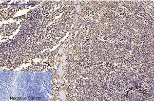 Immunohistochemical analysis of paraffin-embedded human tonsil tissue. (CD68 anticorps)