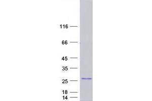 Validation with Western Blot
