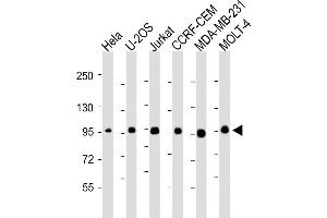 All lanes : Anti-RANBP9 Antibody at 1:2000-1:4000 dilution Lane 1: Hela whole cell lysate Lane 2: U-2OS whole cell lysate Lane 3: Jurkat whole cell lysate Lane 4: CCRF-CEM whole cell lysate Lane 5: MDA-MB-231whole cell lysate Lane 6: MOLT-4 whole cell lysate Lysates/proteins at 20 μg per lane. (Importin 9 anticorps  (AA 1-388))