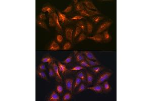 Immunofluorescence analysis of U2OS cells using G/G/G antibody (ABIN3017018, ABIN3017019, ABIN3017020 and ABIN6219924) at dilution of 1:100.
