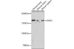 SMC1A 抗体