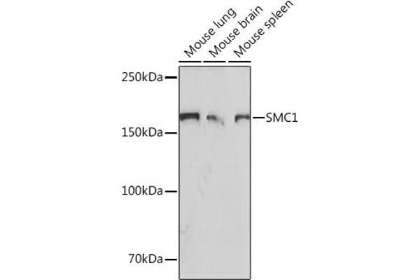 SMC1A Antikörper
