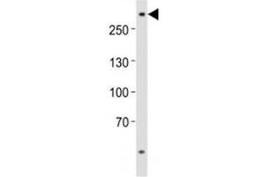 Western blot analysis of lysate from U-87 MG cell line using ABCA2 antibody at 1:1000.