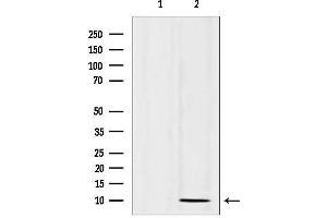 Western blot analysis of lysates from 293, using SPINK1 Antibody.