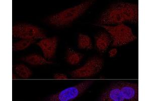 Confocal immunofluorescence analysis of U2OS cells using TAZ Polyclonal Antibody at dilution of 1:100 (60x lens). (TAZ anticorps)