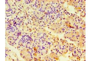 Immunohistochemistry of paraffin-embedded human pancreatic tissue using ABIN7146703 at dilution of 1:100