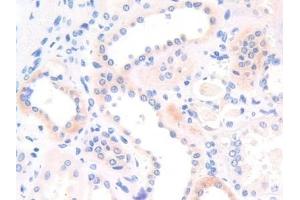 Detection of ADRP in Human Kidney Tissue using Polyclonal Antibody to Adipose Differentiation Related Protein (ADRP)