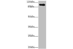 Western blot All lanes: TGFBR3 antibody IgG at 2. (TGFBR3 anticorps  (AA 140-340))