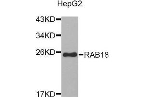 Western blot analysis of extracts of HepG2 cell line, using RAB18 antibody. (RAB18 anticorps  (AA 1-206))