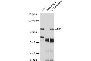 Immunoprecipitation analysis of 200 μg extracts of SKOV3 cells using 3 μg NF2 antibody (ABIN6128275, ABIN6144548, ABIN6144551 and ABIN7101344).