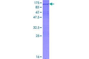 Image no. 1 for X-Ray Repair Complementing Defective Repair in Chinese Hamster Cells 1 (XRCC1) (AA 1-633) protein (GST tag) (ABIN1325459)